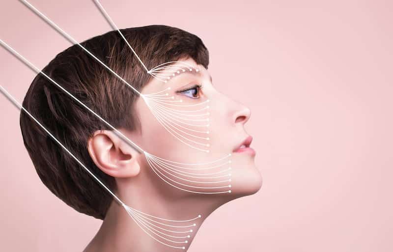 Photographie illustrant les zones de pose de fil d'or